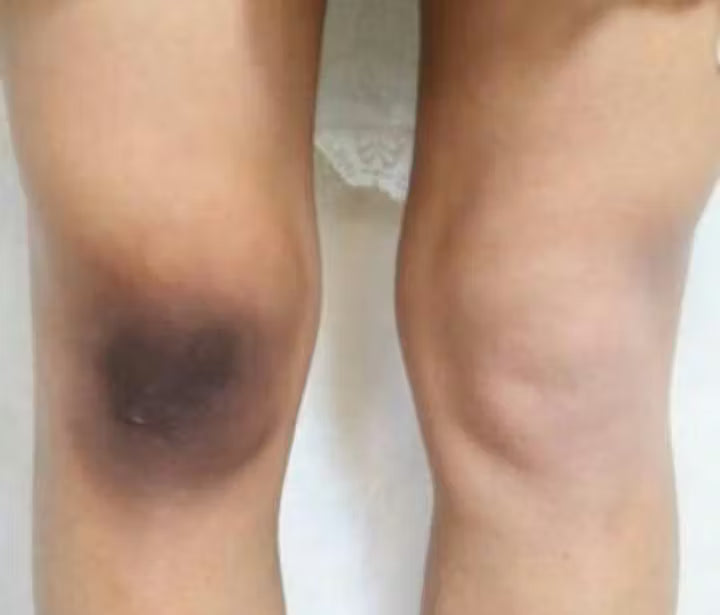 Orange Enzyme Exfoliating Gel